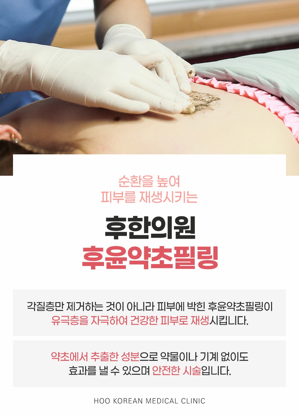 후한의원 후윤약초필링 소개, 약초 성분으로 유극층을 자극해 피부 재생