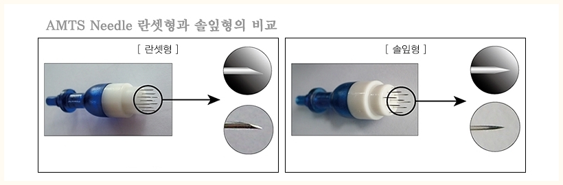 일산여드름자국 니들 비교 사진