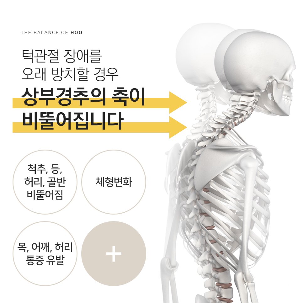 턱관절 장애 방치하면 생기는일