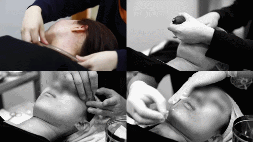 일산턱관절한의원 치료 방법