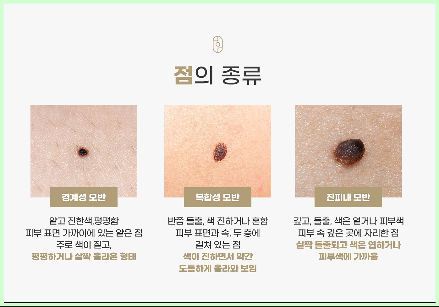 점의 종류를 사진과 함께 설명하는 이미지