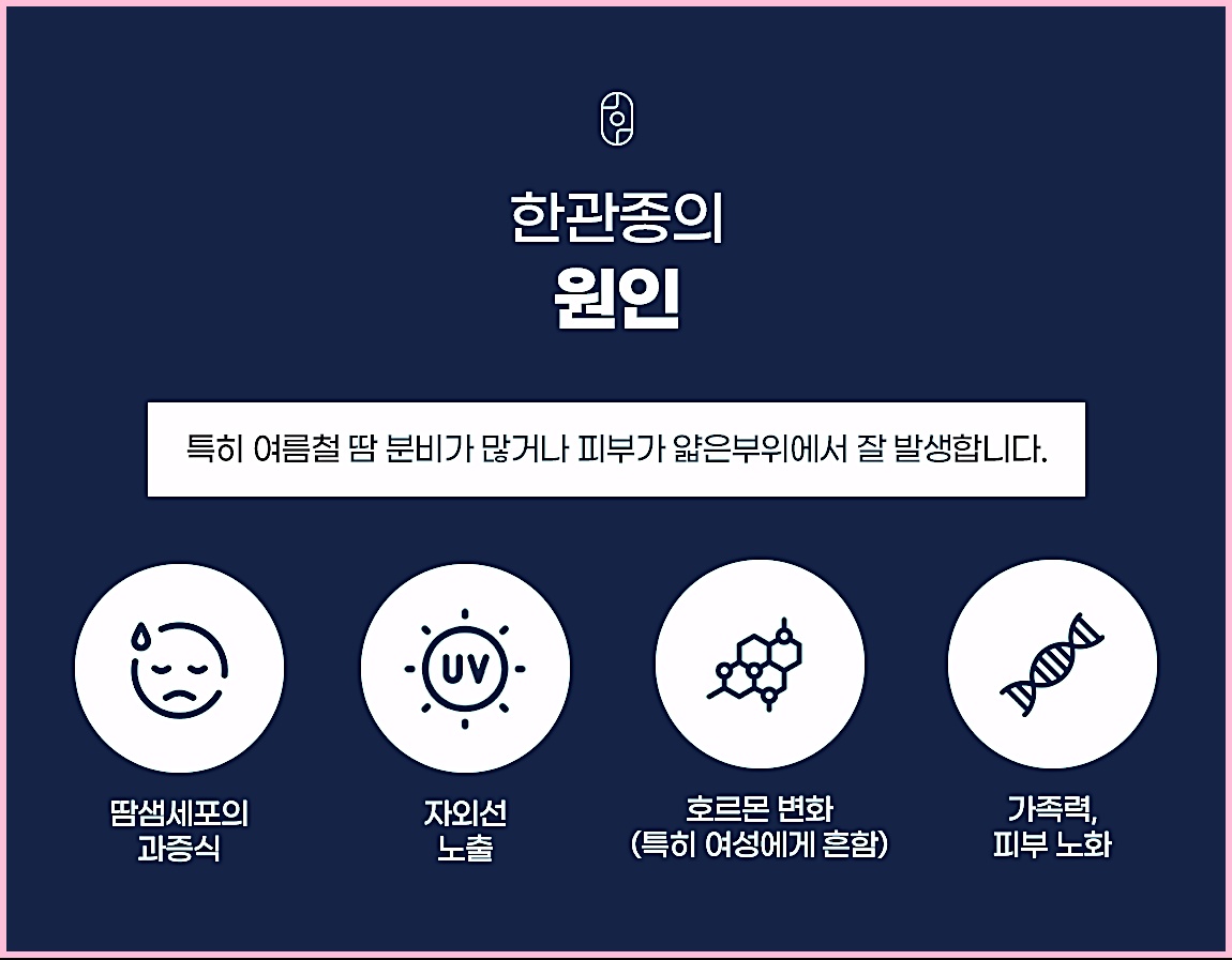 한관종의 원인 - 땀샘세포 과증식, 자외선 노출, 호르몬 변화, 가족력을 설명