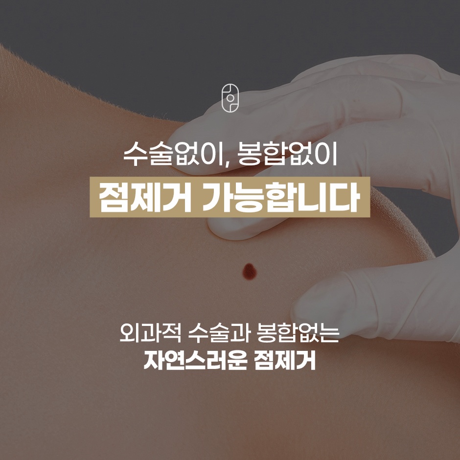 외과적 수술과 봉합 없이 진행되는 자연스러운 점제거 케어