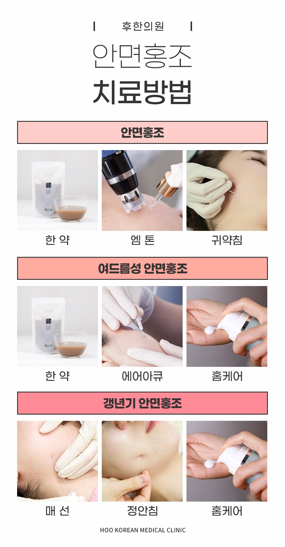 한약·엠톤·귀약침부터 에어아큐, 매선, 정안침까지 안면홍조 유형별 치료방법