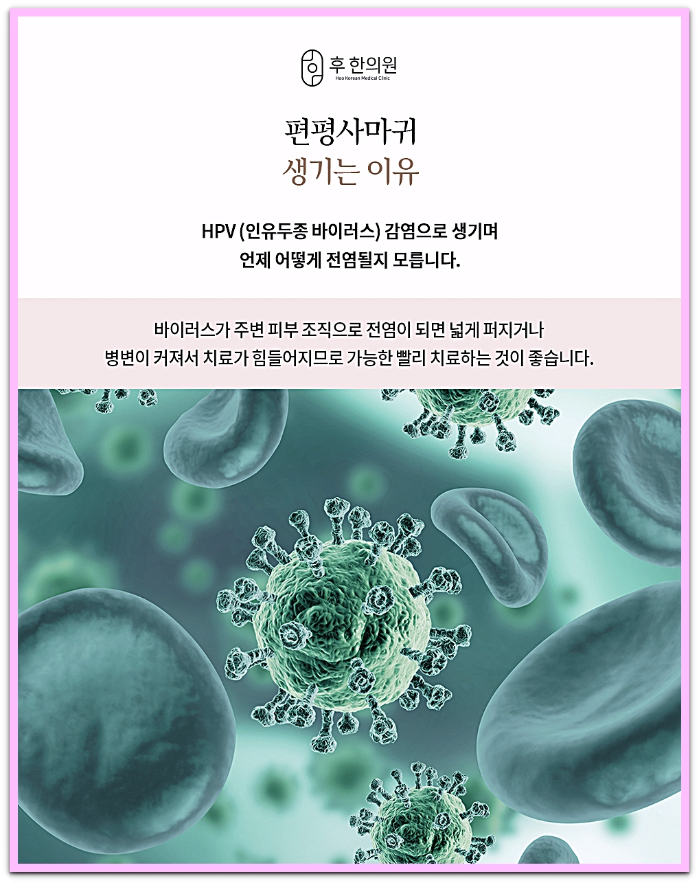 편평사마귀가 생기는 이유를 설명한 HPV 바이러스 이미지