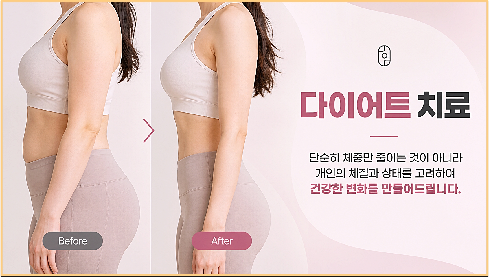 일산다이어트한약 개인의 체질과 상태를 고려하는 한방 다이어트 치료
